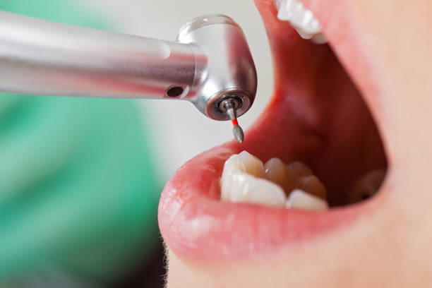 Best Weekend Emergency Dentist in Southmont, NC